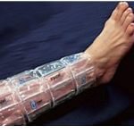 Cryopak